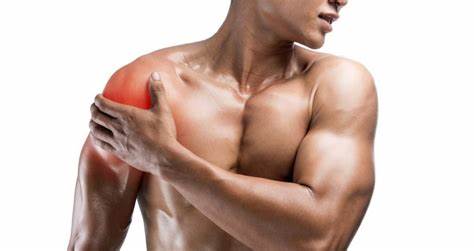 CBD and Muscle Soreness: Exploring the Benefits for Recovery and Relief